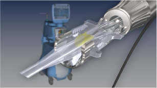 Рукоятка-инжектор для автоматической имплантации ИОЛ INTREPID Autosert