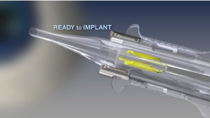Рукоятка-инжектор для автоматической имплантации ИОЛ INTREPID Autosert
